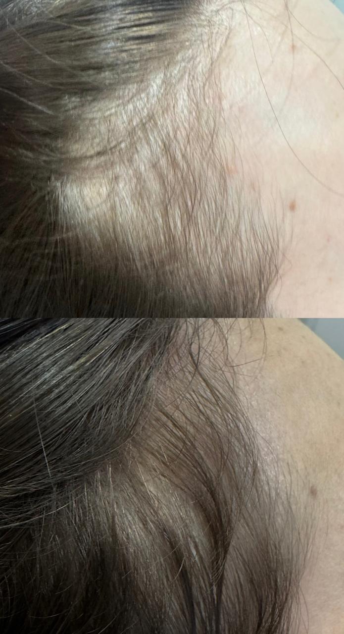Evolução capilar — antes e depois