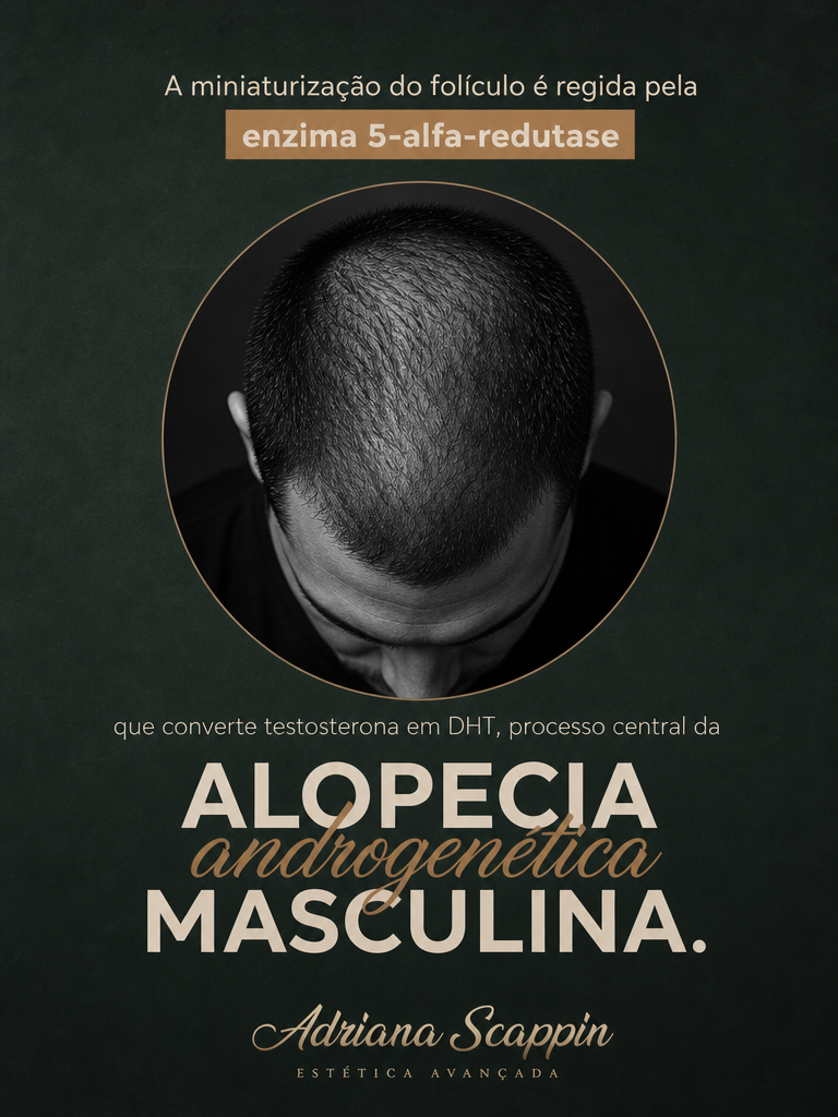 Post: alopecia androgenética